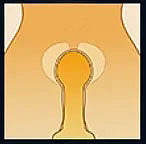 MW Girl(魔物姫) 小春（はる）ヘッド 115cm 猫耳×ピンク髪美少女フルシリコン製リアルドール​